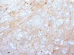Fibronectin Antibody in Immunohistochemistry (Paraffin) (IHC (P))