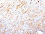 Fibronectin Monoclonal Antibody (SPM246)