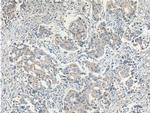FOLR1 Antibody in Immunohistochemistry (Paraffin) (IHC (P))