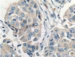 FOLR1 Antibody in Immunohistochemistry (Paraffin) (IHC (P))