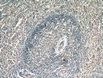 ACOXL Antibody in Immunohistochemistry (Paraffin) (IHC (P))
