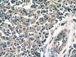 ACOXL Antibody in Immunohistochemistry (Paraffin) (IHC (P))
