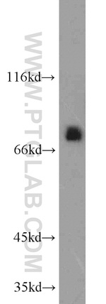 UBQLN3 Antibody in Western Blot (WB)