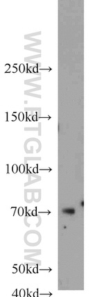 UBQLN3 Antibody in Western Blot (WB)