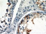 UBQLN3 Antibody in Immunohistochemistry (Paraffin) (IHC (P))