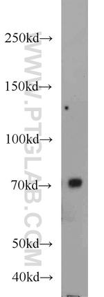 UBQLN3 Antibody in Western Blot (WB)