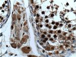 ZCCHC8 Antibody in Immunohistochemistry (Paraffin) (IHC (P))