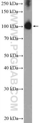 ZCCHC8 Antibody in Western Blot (WB)