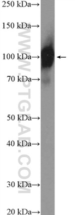 ZCCHC8 Antibody in Western Blot (WB)