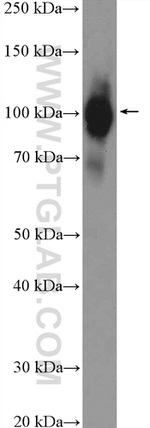 ZCCHC8 Antibody in Western Blot (WB)