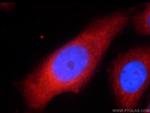 UPF1 Antibody in Immunocytochemistry (ICC/IF)