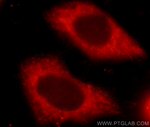 UPF1 Antibody in Immunocytochemistry (ICC/IF)
