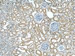 UPF1 Antibody in Immunohistochemistry (Paraffin) (IHC (P))