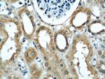 UPF1 Antibody in Immunohistochemistry (Paraffin) (IHC (P))