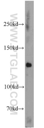 UPF1 Antibody in Western Blot (WB)