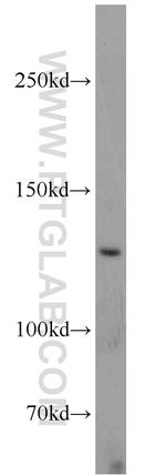 UPF1 Antibody in Western Blot (WB)
