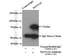 MAN1A1 Antibody in Immunoprecipitation (IP)