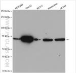 MAN1A1 Antibody in Western Blot (WB)