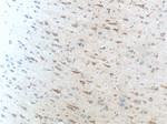 SCD Antibody in Immunohistochemistry (Paraffin) (IHC (P))