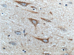 SCD Antibody in Immunohistochemistry (Paraffin) (IHC (P))