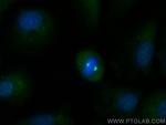 WDR62 Antibody in Immunocytochemistry (ICC/IF)