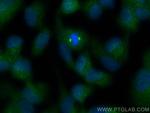 WDR62 Antibody in Immunocytochemistry (ICC/IF)