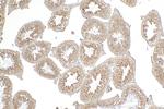 WDR62 Antibody in Immunohistochemistry (Paraffin) (IHC (P))