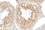 WDR62 Antibody in Immunohistochemistry (Paraffin) (IHC (P))