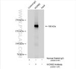 WDR62 Antibody in Immunoprecipitation (IP)