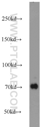 DNAJC21 Antibody in Western Blot (WB)