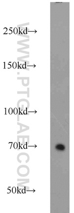 DNAJC21 Antibody in Western Blot (WB)