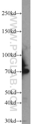 DNAJC21 Antibody in Western Blot (WB)