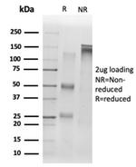 Sirtuin1 (SIRT1) Antibody in SDS-PAGE (SDS-PAGE)
