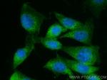 Osteocalcin Antibody in Immunocytochemistry (ICC/IF)
