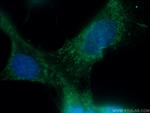 Osteocalcin Antibody in Immunocytochemistry (ICC/IF)