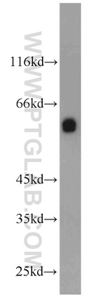 CBX6 Antibody in Western Blot (WB)