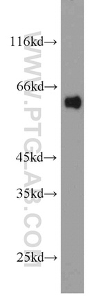 CBX6 Antibody in Western Blot (WB)