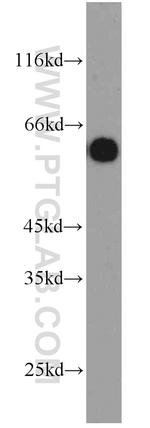 CBX6 Antibody in Western Blot (WB)