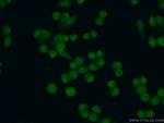 CEBPB Antibody in Immunocytochemistry (ICC/IF)