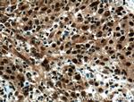 CEBPB Antibody in Immunohistochemistry (Paraffin) (IHC (P))