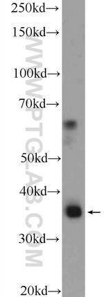 CEBPB Antibody in Western Blot (WB)