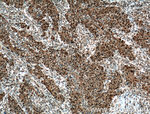 CEBPB Antibody in Immunohistochemistry (Paraffin) (IHC (P))