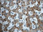 TTC39B Antibody in Immunohistochemistry (Paraffin) (IHC (P))