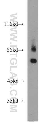 TTC39B Antibody in Western Blot (WB)