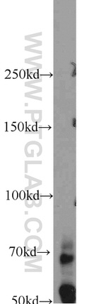 TTC39B Antibody in Western Blot (WB)