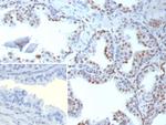 TARDBP TAR DNA binding protein/TDP43 Recombinant Rabbit Monoclonal Antibody (TARDP/9299R)
