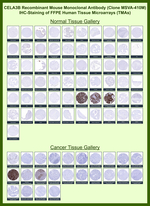 CELA3B/ELA3B (Pancreatic Function Marker) Recombinant Mouse Monoclonal Antibody (MSVA-410M)