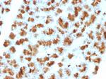 CELA3B/ELA3B (Pancreatic Function Marker) Antibody in Immunohistochemistry (Paraffin) (IHC (P))