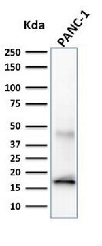 CELA3B/ELA3B (Pancreatic Function Marker) Antibody in Western Blot (WB)