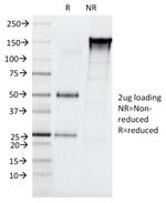 CELA3B/ELA3B (Pancreatic Function Marker) Antibody in SDS-PAGE (SDS-PAGE)